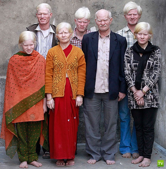 Где живут альбиносы?... Самая большая семья в Индии...