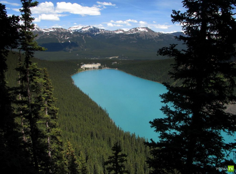    (Lake Louise) (30 )