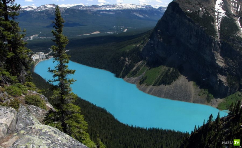    (Lake Louise) (30 )