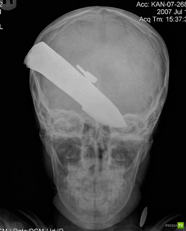 ��������� ������������� ������ (20 ����)