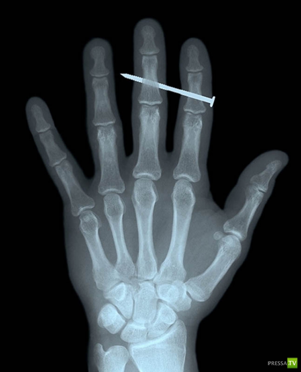 ��������� ������������� ������ (20 ����)