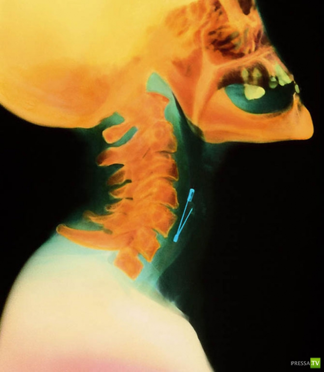 ��������� ������������� ������ (20 ����)