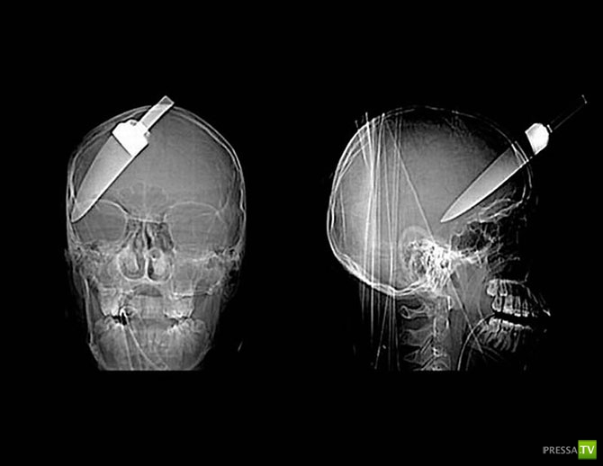 ��������� ������������� ������ (20 ����)