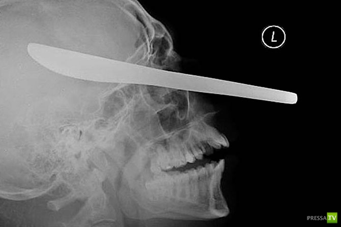 ��������� ������������� ������ (20 ����)