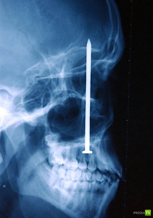 ��������� ������������� ������ (20 ����)