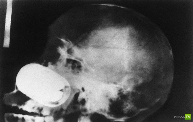 ��������� ������������� ������ (20 ����)