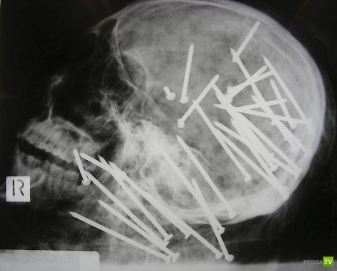 ��������� ������������� ������ (20 ����)