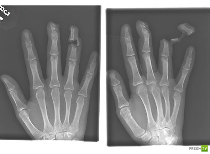 ��������� ������������� ������ (20 ����)