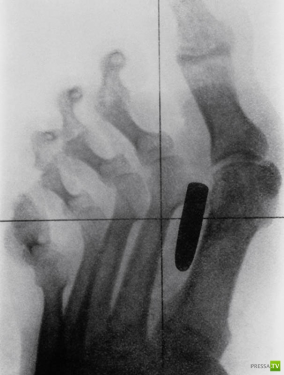 ��������� ������������� ������ (20 ����)