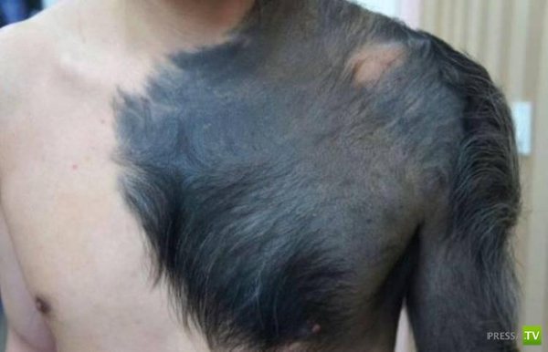 Китаец обрастает шерстью (3 фото) Китаец обрастает шерстью (3 фото)