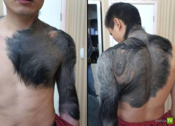 Китаец обрастает шерстью (3 фото) Китаец обрастает шерстью (3 фото)