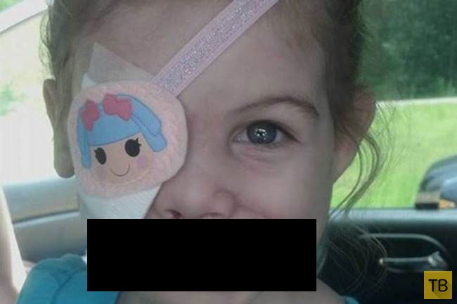 В США выгнали девочку из ресторана KFC из-за шрамов на лице (3 фото)