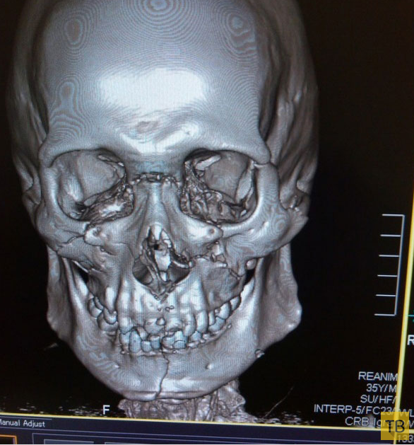 Врач-рентгенолог о пациентах с его ночного дежурства (10 фото)