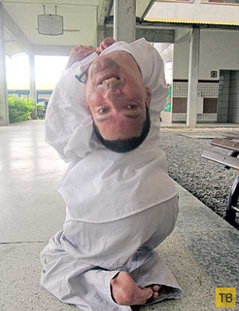 37-летний мужчина с перевернутой головой (6 фото)