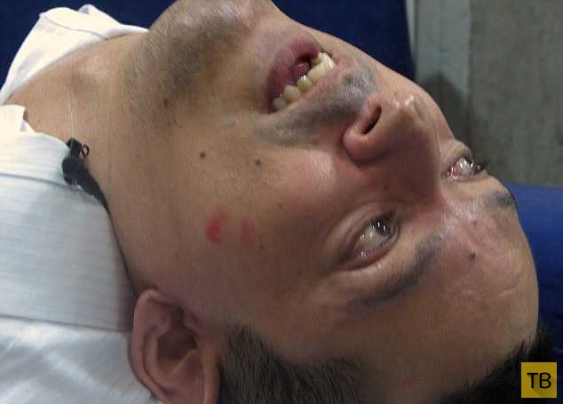 37-летний мужчина с перевернутой головой (6 фото)