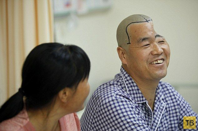 Врачи распечатали китайскому фермеру новый череп (5 фото)