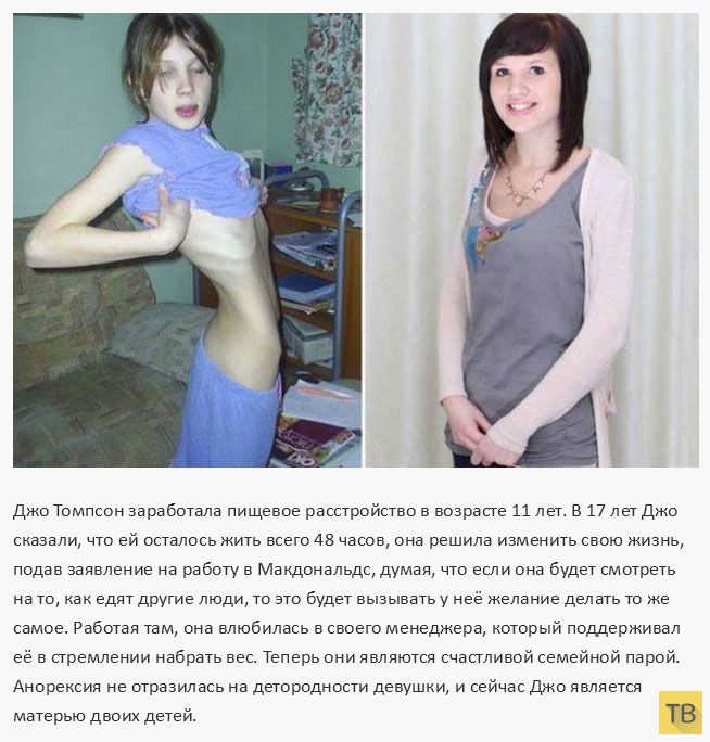 Девушки, победившие анорексию (14 фото)